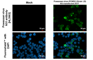 Anti-Powassan virus NS1 antibody [HL3963] used in Immunocytochemistry/ Immunofluorescence (ICC/IF). GTX642213